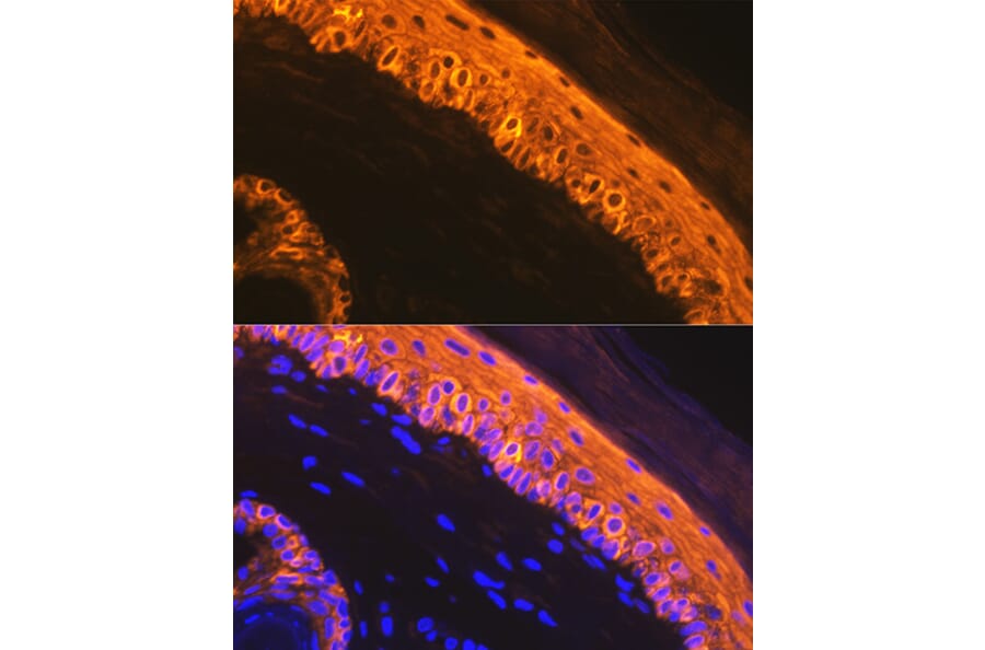 Immunofluorescence - Anti-Cytokeratin 1 Antibody [ARC1745] (A306008) - Antibodies.com