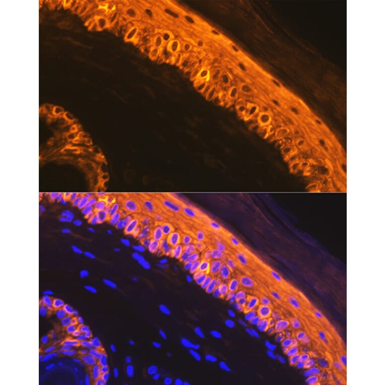 Immunofluorescence - Anti-Cytokeratin 1 Antibody [ARC1745] (A306008) - Antibodies.com