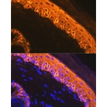 Immunofluorescence - Anti-Cytokeratin 1 Antibody [ARC1745] (A306008) - Antibodies.com