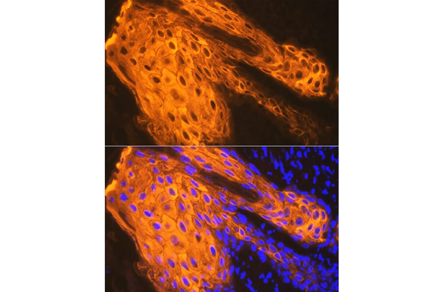 Immunofluorescence - Anti-Cytokeratin 1 Antibody [ARC1745] (A306008) - Antibodies.com