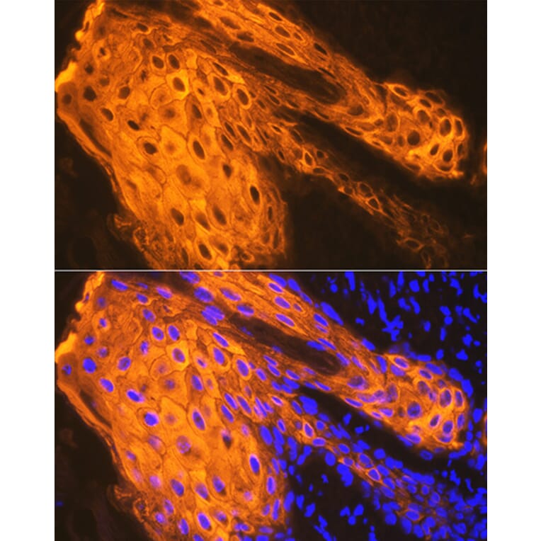 Immunofluorescence - Anti-Cytokeratin 1 Antibody [ARC1745] (A306008) - Antibodies.com