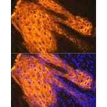 Immunofluorescence - Anti-Cytokeratin 1 Antibody [ARC1745] (A306008) - Antibodies.com