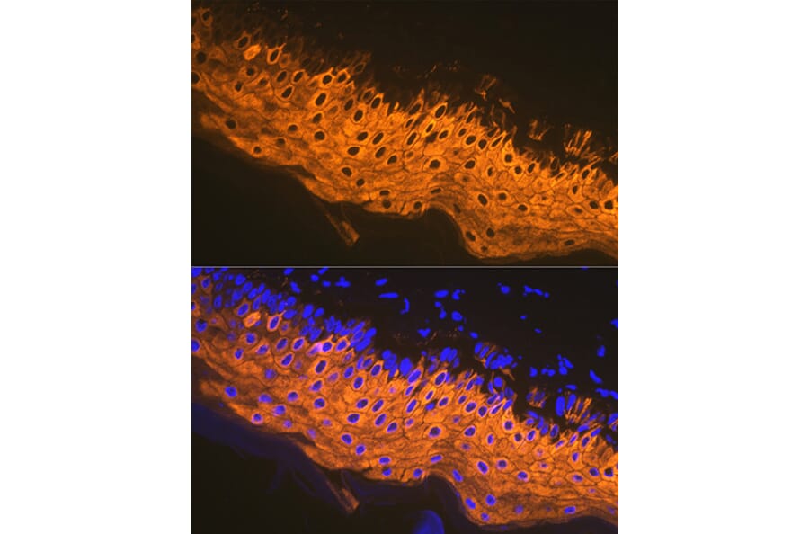 Immunofluorescence - Anti-Cytokeratin 1 Antibody [ARC1745] (A306008) - Antibodies.com