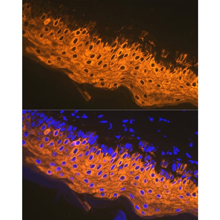 Immunofluorescence - Anti-Cytokeratin 1 Antibody [ARC1745] (A306008) - Antibodies.com