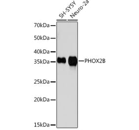 Western Blot - Anti-PHOX2B Antibody [ARC1420] (A306009) - Antibodies.com