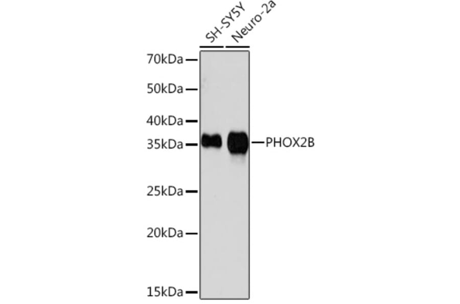 Western Blot - Anti-PHOX2B Antibody [ARC1420] (A306009) - Antibodies.com