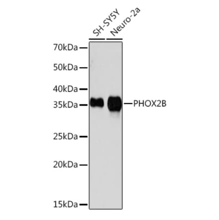 Western Blot - Anti-PHOX2B Antibody [ARC1420] (A306009) - Antibodies.com