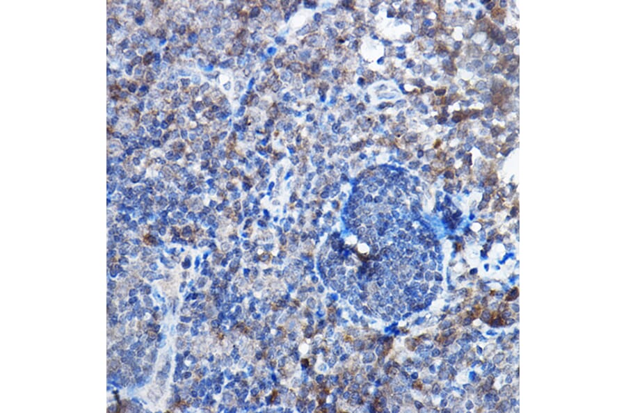 Immunohistochemistry - Anti-Bax Antibody [ARC5006-10] (A306010) - Antibodies.com