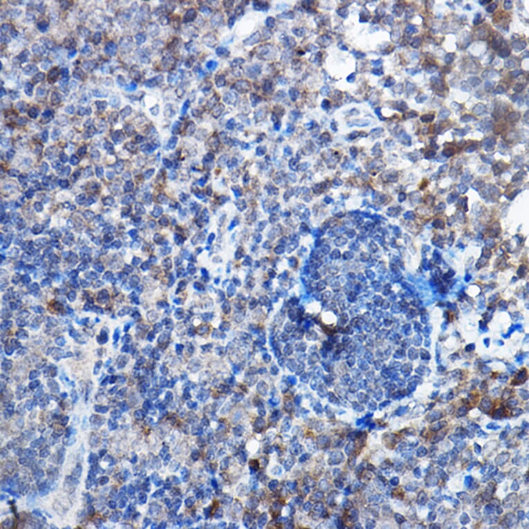 Immunohistochemistry - Anti-Bax Antibody [ARC5006-10] (A306010) - Antibodies.com