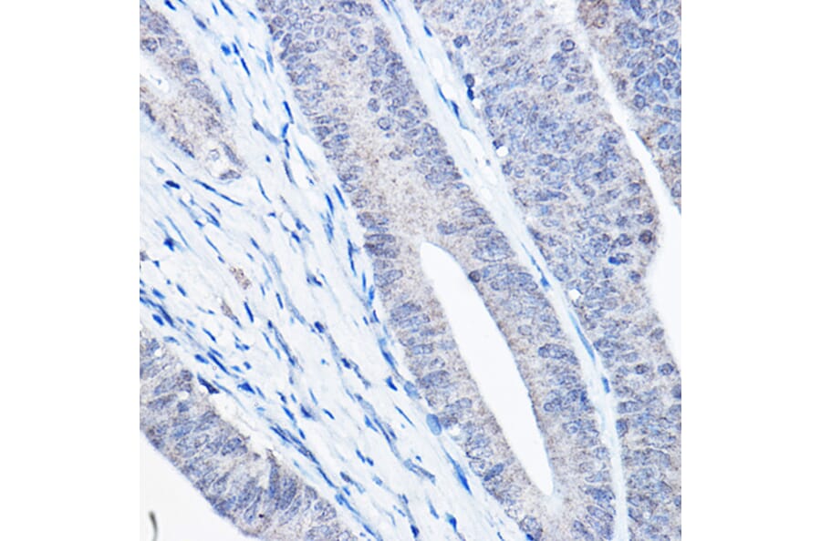 Immunohistochemistry - Anti-Bax Antibody [ARC5006-10] (A306010) - Antibodies.com