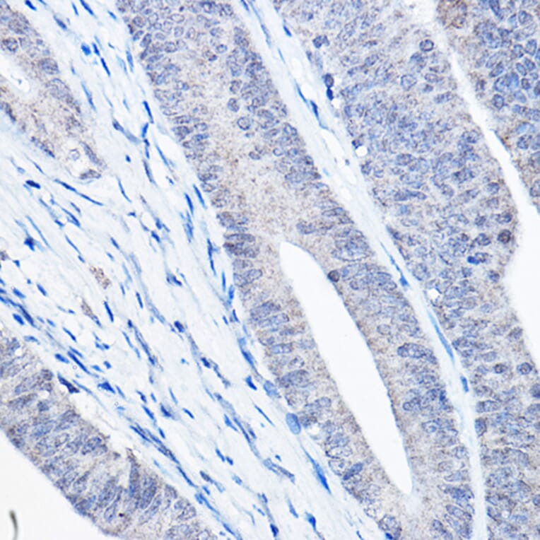 Immunohistochemistry - Anti-Bax Antibody [ARC5006-10] (A306010) - Antibodies.com