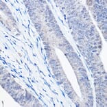 Immunohistochemistry - Anti-Bax Antibody [ARC5006-10] (A306010) - Antibodies.com