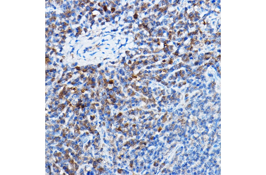 Immunohistochemistry - Anti-Bax Antibody [ARC5006-10] (A306010) - Antibodies.com