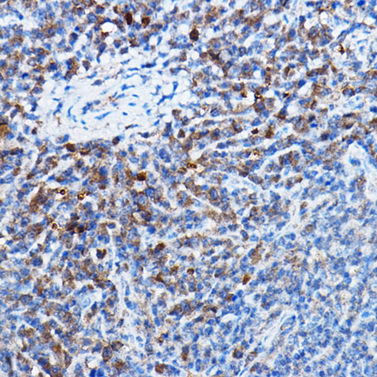 Immunohistochemistry - Anti-Bax Antibody [ARC5006-10] (A306010) - Antibodies.com