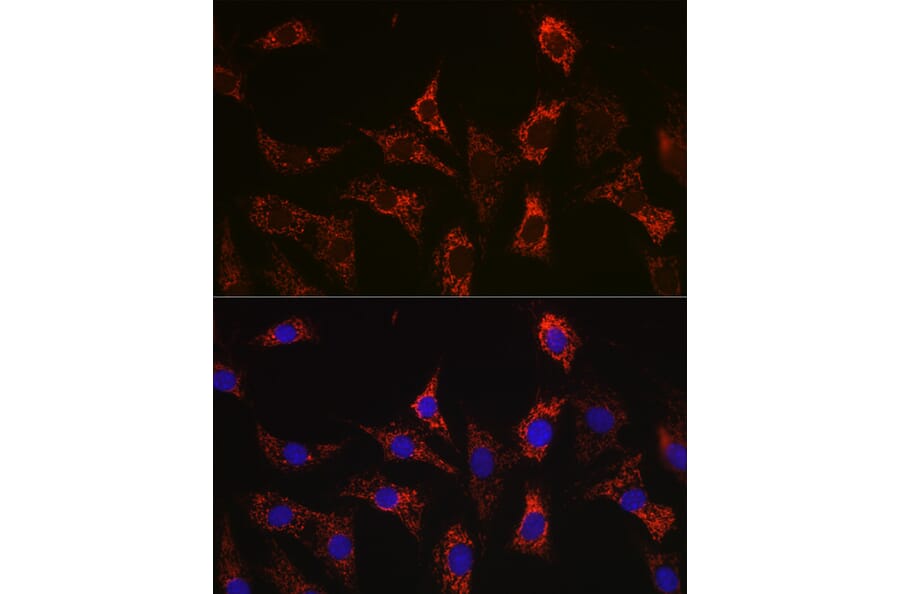 Immunofluorescence - Anti-Bax Antibody [ARC5006-10] (A306010) - Antibodies.com