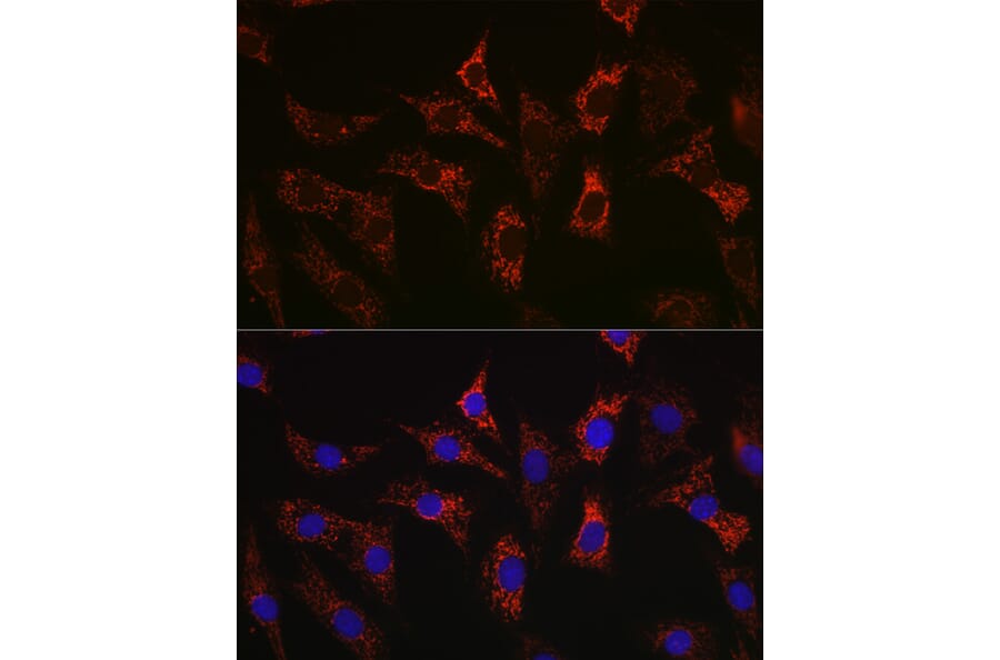 Immunofluorescence - Anti-Bax Antibody [ARC5006-10] (A306010) - Antibodies.com