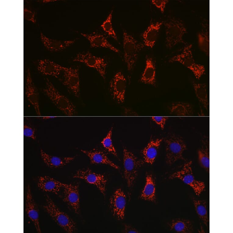 Immunofluorescence - Anti-Bax Antibody [ARC5006-10] (A306010) - Antibodies.com