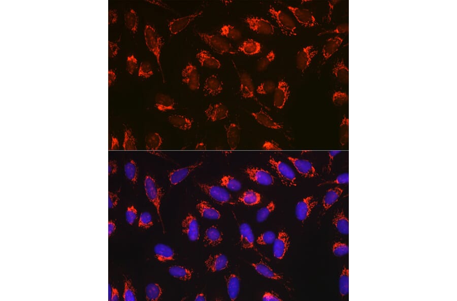 Immunofluorescence - Anti-Bax Antibody [ARC5006-10] (A306010) - Antibodies.com