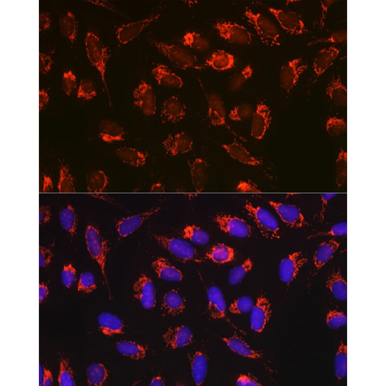 Immunofluorescence - Anti-Bax Antibody [ARC5006-10] (A306010) - Antibodies.com
