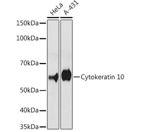 Western Blot - Anti-Cytokeratin 10 Antibody [ARC1084] (A306012) - Antibodies.com
