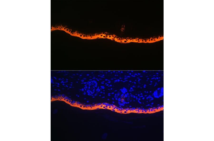 Immunofluorescence - Anti-Cytokeratin 10 Antibody [ARC1084] (A306012) - Antibodies.com