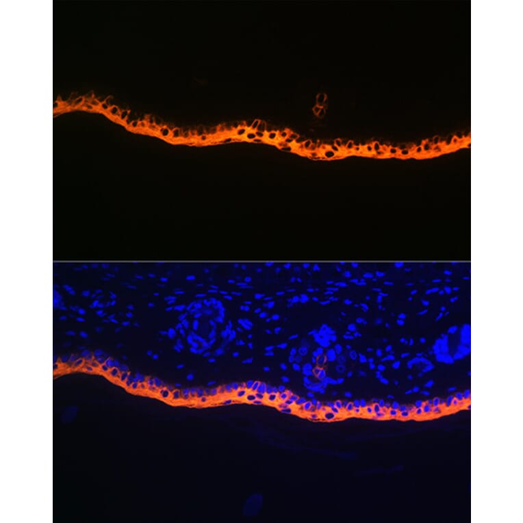 Immunofluorescence - Anti-Cytokeratin 10 Antibody [ARC1084] (A306012) - Antibodies.com