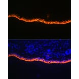Immunofluorescence - Anti-Cytokeratin 10 Antibody [ARC1084] (A306012) - Antibodies.com