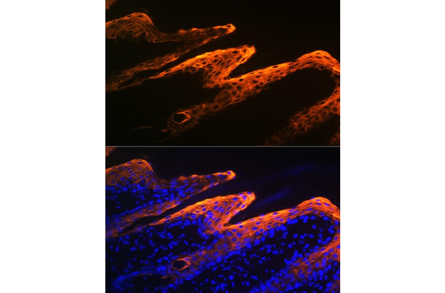 Immunofluorescence - Anti-Cytokeratin 10 Antibody [ARC1084] (A306012) - Antibodies.com