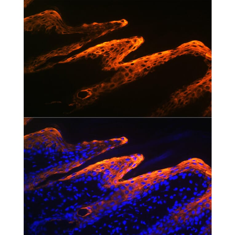 Immunofluorescence - Anti-Cytokeratin 10 Antibody [ARC1084] (A306012) - Antibodies.com