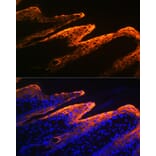 Immunofluorescence - Anti-Cytokeratin 10 Antibody [ARC1084] (A306012) - Antibodies.com