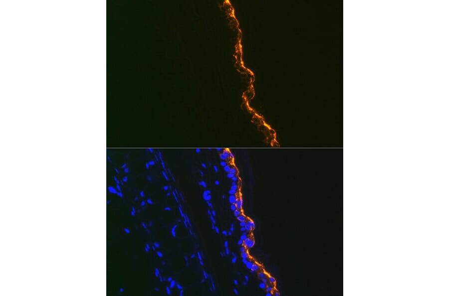 Immunofluorescence - Anti-Cytokeratin 10 Antibody [ARC1084] (A306012) - Antibodies.com