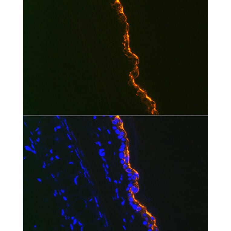 Immunofluorescence - Anti-Cytokeratin 10 Antibody [ARC1084] (A306012) - Antibodies.com