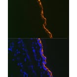 Immunofluorescence - Anti-Cytokeratin 10 Antibody [ARC1084] (A306012) - Antibodies.com
