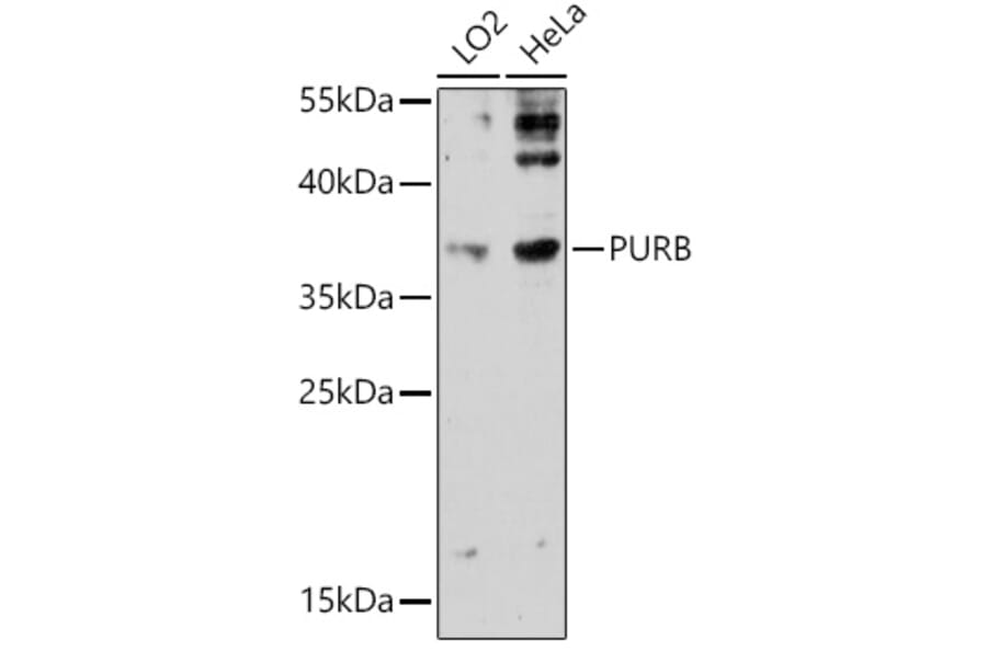 Western Blot - Anti-Pur B Antibody (A306014) - Antibodies.com
