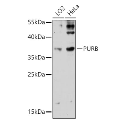 Western Blot - Anti-Pur B Antibody (A306014) - Antibodies.com