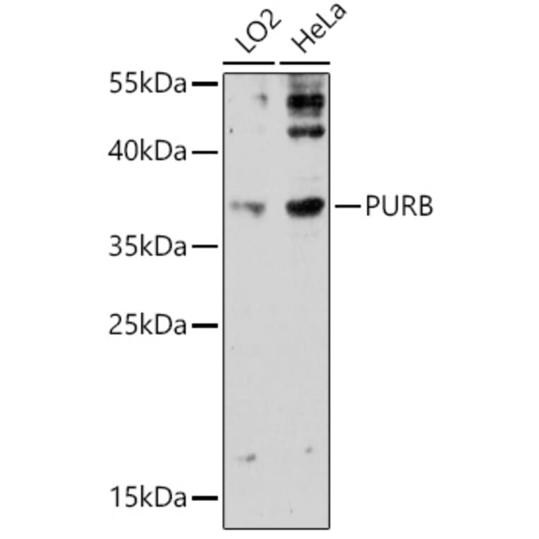 Western Blot - Anti-Pur B Antibody (A306014) - Antibodies.com