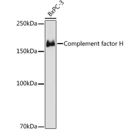 Western Blot - Anti-Factor H Antibody [ARC1306] (A306015) - Antibodies.com