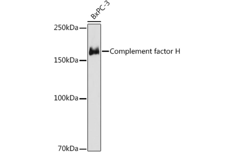 Western Blot - Anti-Factor H Antibody [ARC1306] (A306015) - Antibodies.com