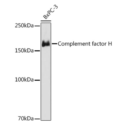 Western Blot - Anti-Factor H Antibody [ARC1306] (A306015) - Antibodies.com