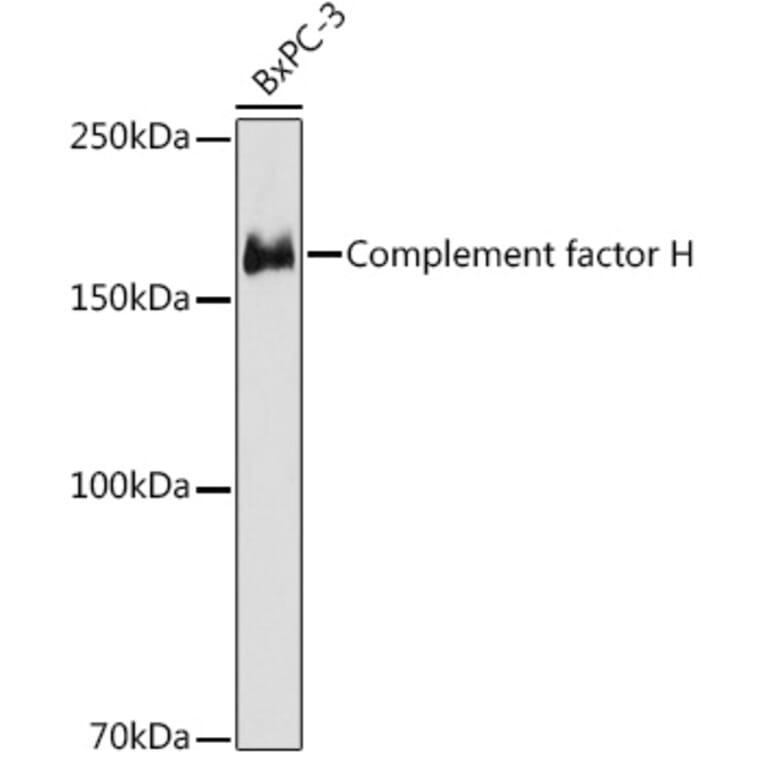 Western Blot - Anti-Factor H Antibody [ARC1306] (A306015) - Antibodies.com