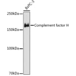 Western Blot - Anti-Factor H Antibody [ARC1306] (A306015) - Antibodies.com