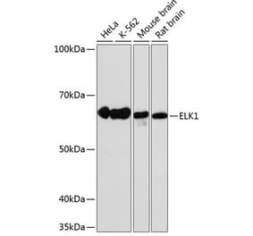 Western Blot - Anti-ELK1 Antibody [ARC0339] (A306016) - Antibodies.com