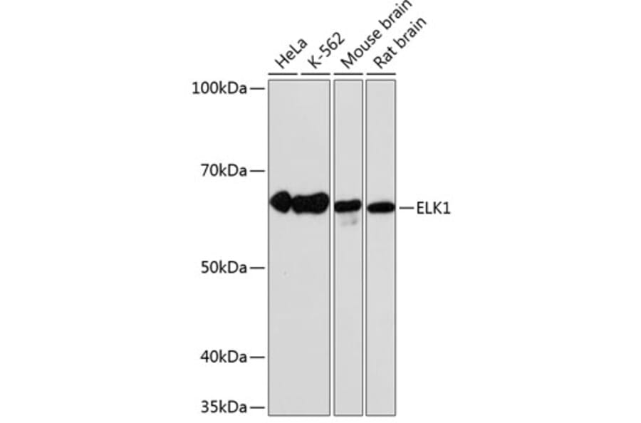 Western Blot - Anti-ELK1 Antibody [ARC0339] (A306016) - Antibodies.com