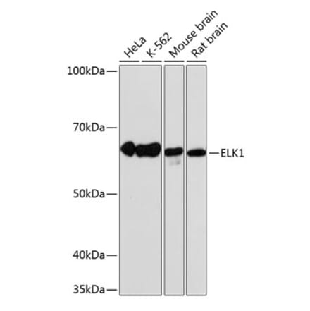 Western Blot - Anti-ELK1 Antibody [ARC0339] (A306016) - Antibodies.com