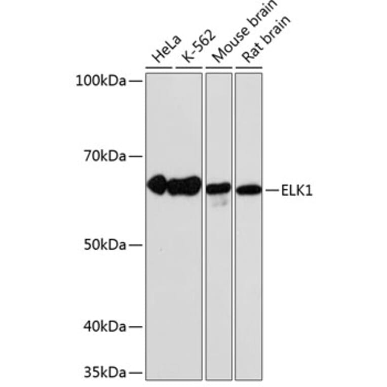 Western Blot - Anti-ELK1 Antibody [ARC0339] (A306016) - Antibodies.com