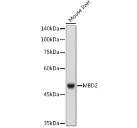 Western Blot - Anti-MBD2 Antibody [ARC2691] (A306017) - Antibodies.com