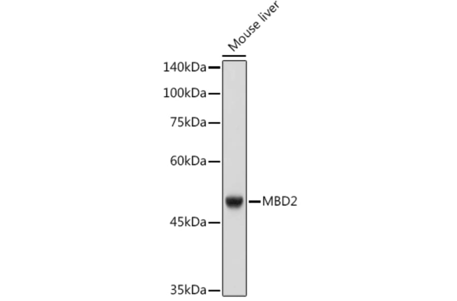 Western Blot - Anti-MBD2 Antibody [ARC2691] (A306017) - Antibodies.com