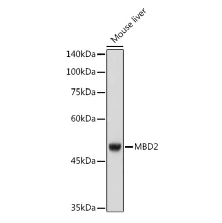 Western Blot - Anti-MBD2 Antibody [ARC2691] (A306017) - Antibodies.com