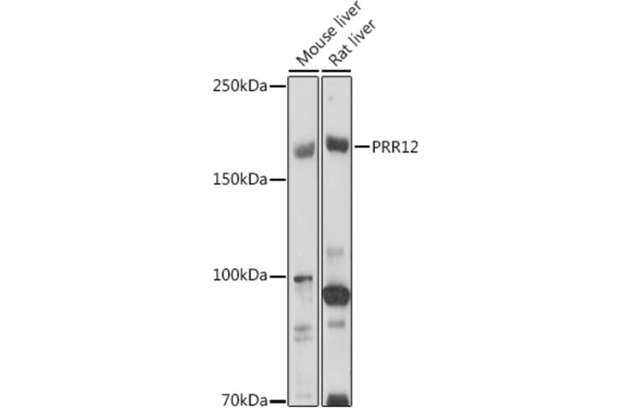 Western Blot - Anti-PRR12 Antibody (A306018) - Antibodies.com