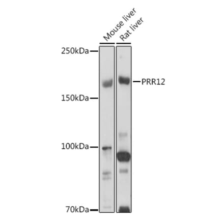 Western Blot - Anti-PRR12 Antibody (A306018) - Antibodies.com